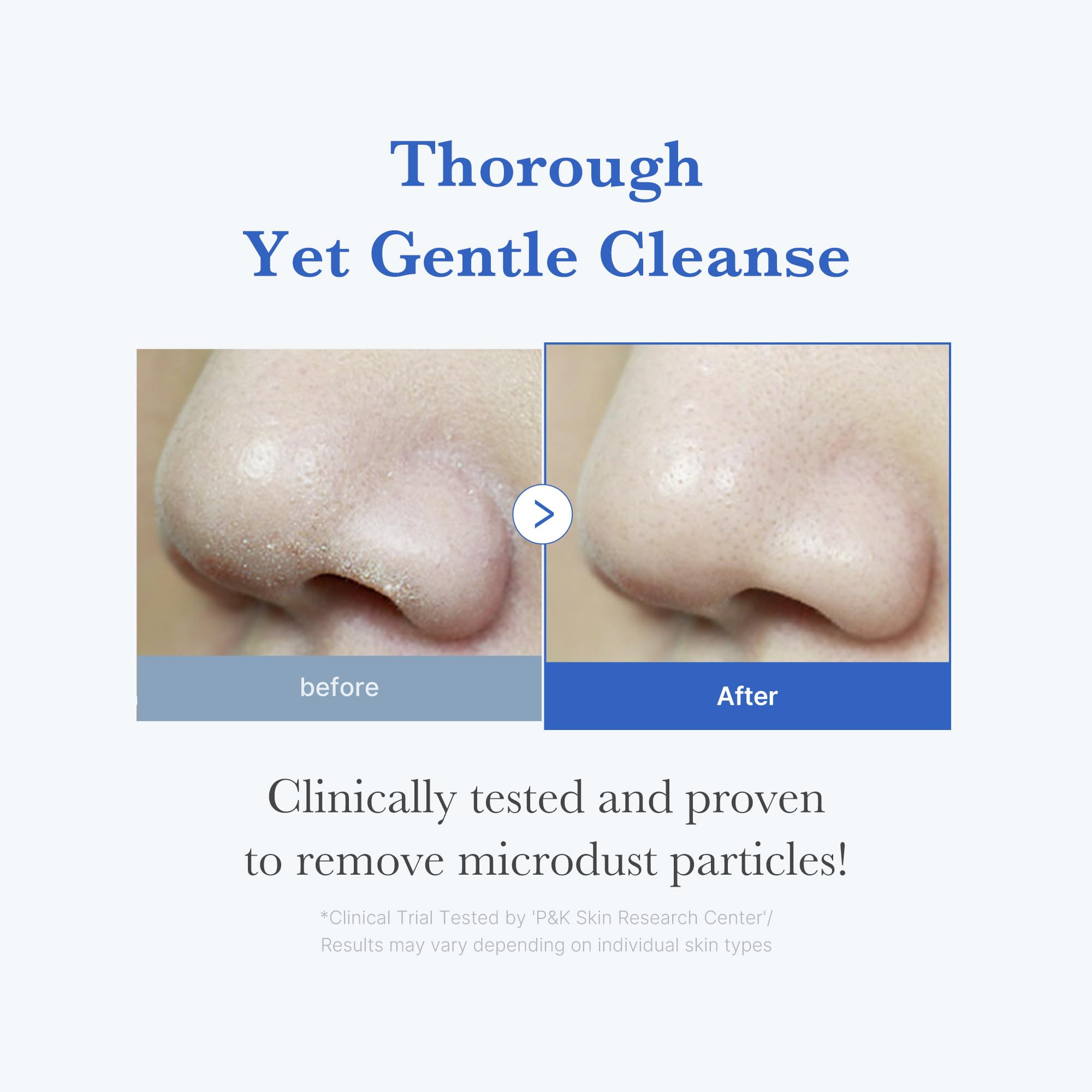 medicube Facial Cleanser Zero Pore Capsule Cleansing Foam | Daily Gentle Cleanser for Skin Texture, Blackhead & Pore Care | AHA, BHA & PHA for Deep Cleansing | Korean Skincare, 4.23 oz