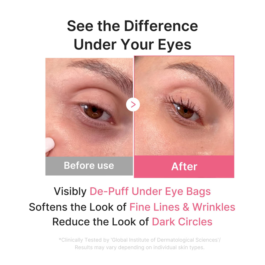 medicube PDRN Pink Collagen Jelly Eye Mask | Hydrogel Eye Patches with PDRN, Collagen, NAD | Refreshing for Puffy, Tired Eyes | Firming for Look of Wrinkles, Fine Lines | Korean Skincare (50 Pairs)
